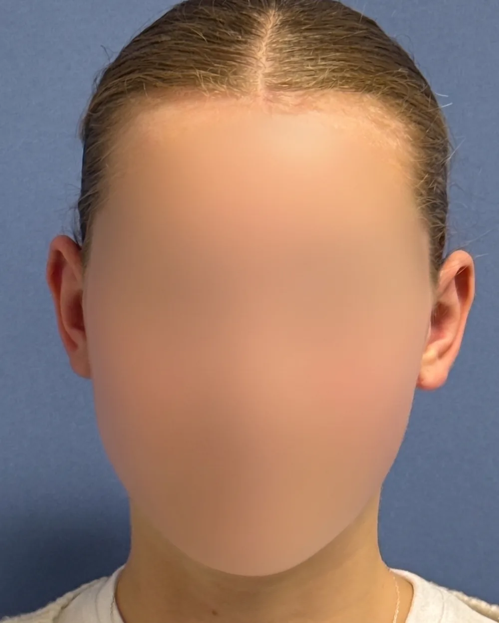 Face on, after surgery