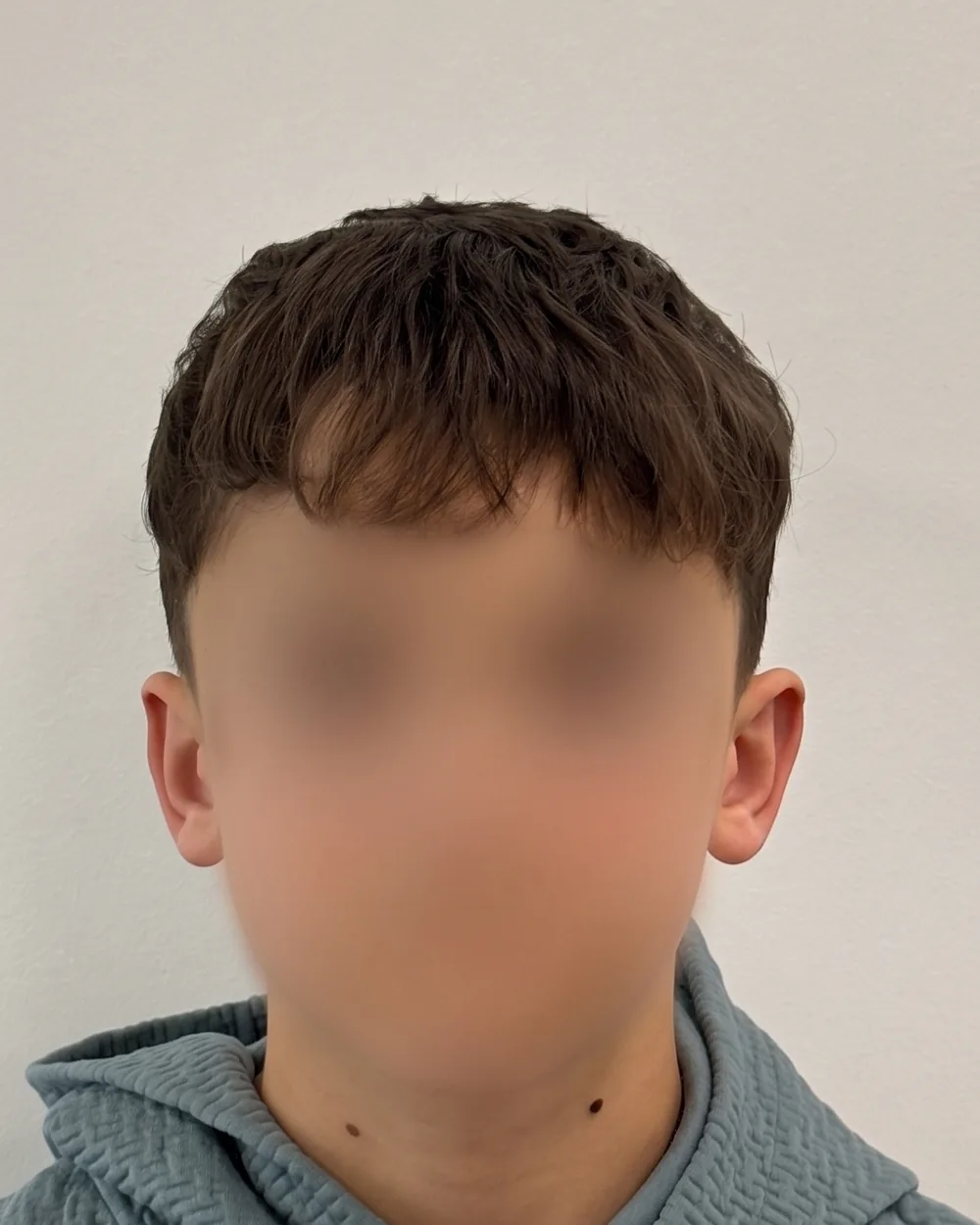 Face on, after surgery