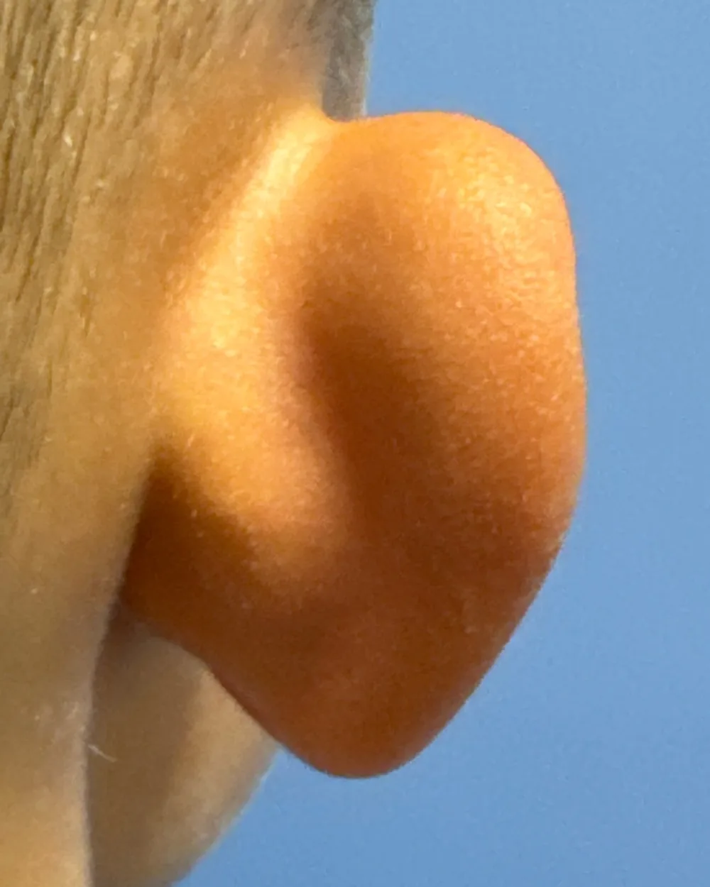 Behind the right ear, before surgery