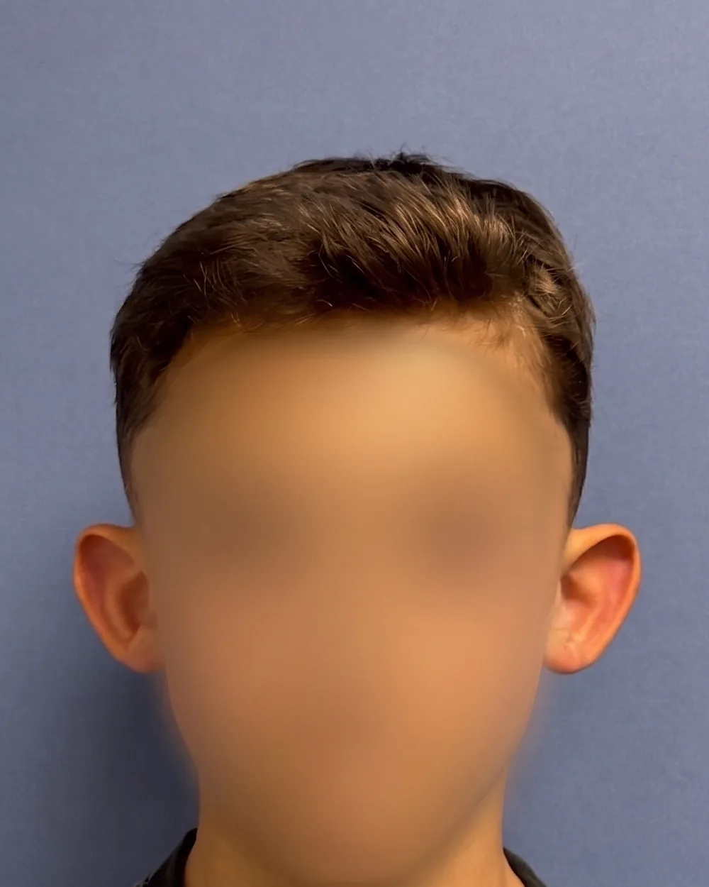 Face on, before surgery