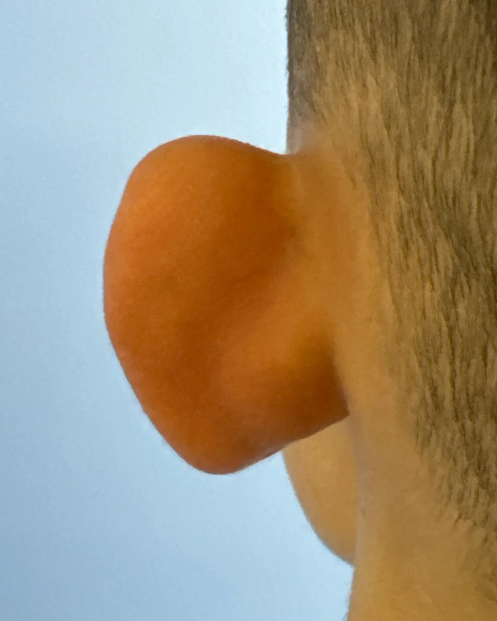 Behind the left ear, before surgery