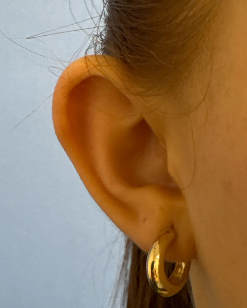 Right ear, from the front, before surgery