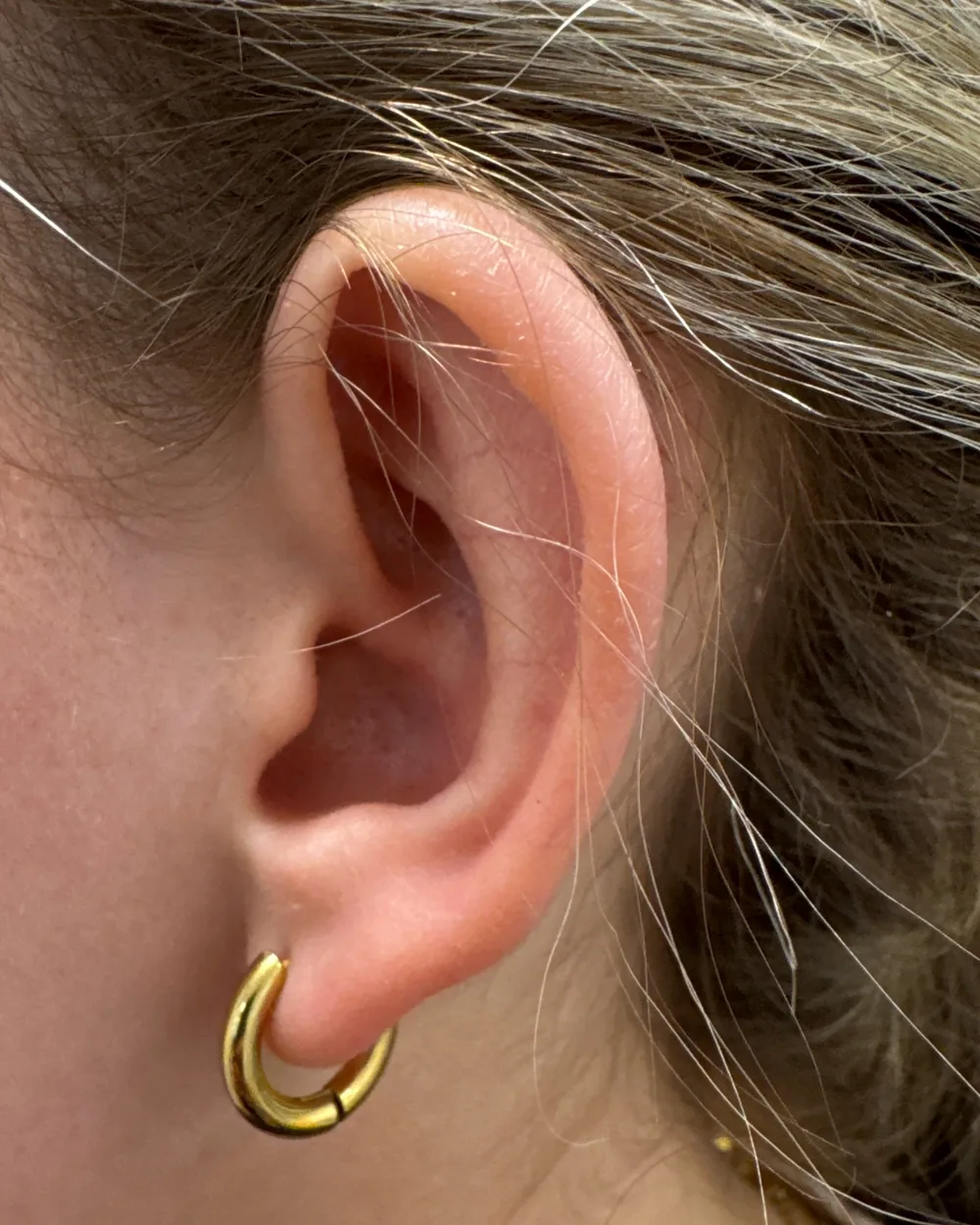 Left ear, from the side, before surgery